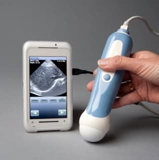 This personal ultrasound machine connects directly to your smartphone.